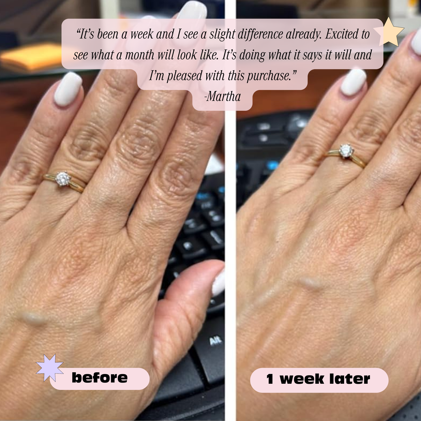 Retinol Anti-Aging Hand Cream