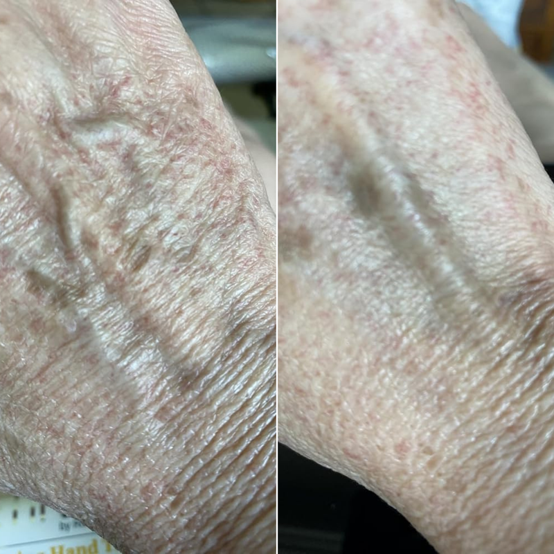 Real customer results