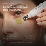 Before and after results using Retinol by Robanda Active Renewal Eye Gel — visibly smoother, more even-toned skin